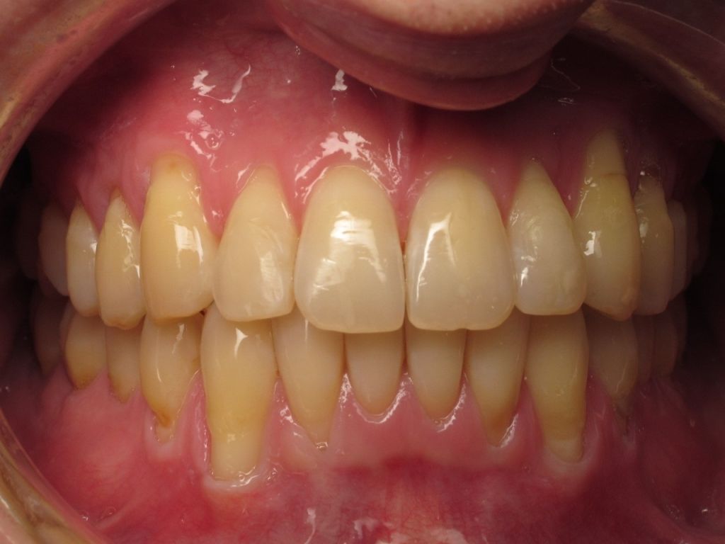 Dents du bonheur orthodontie