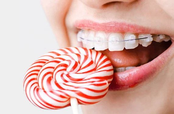 Conseils à Flandres Orthodontie : alimentation adaptée aux traitements