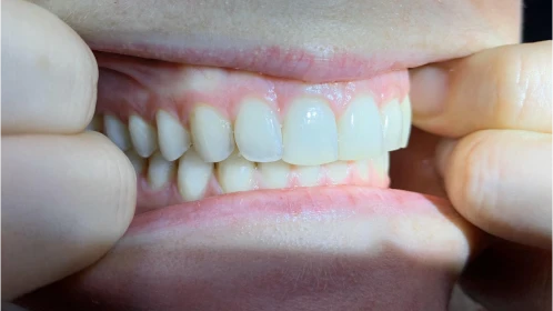 Analyse personnalisée au Cabinet Flandres Orthodontie à Lille (59000)