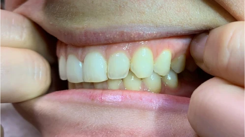 Analyse personnalisée au cabinet d'orthodontie Flandres Orthodontie