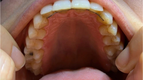 Analyse personnalisée : Docteur Etienne Payart, orthodontiste à Lill et Hazebrouck