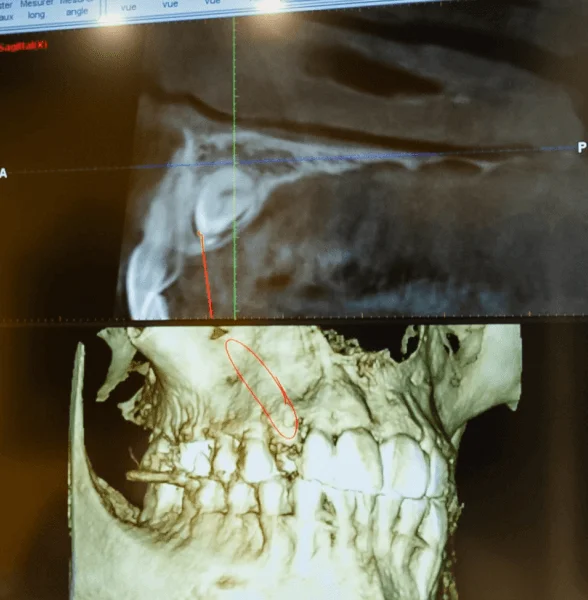 Cone beam : technologies au cabinet d'orthodontie à Lille