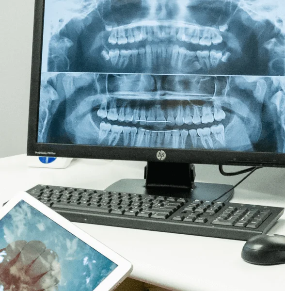 Technologies au Cabinet Flandres Orthodontie : radiographie