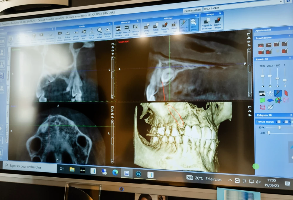 Technologies à Flandres Orthodontie : cone beam