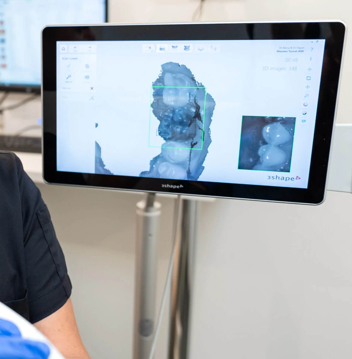 Orthodontie pour enfants aux cabinets Flandres Orthodontie des Drs Biecq & Payart à Lille et Hazebrouck : gouttières transparentes