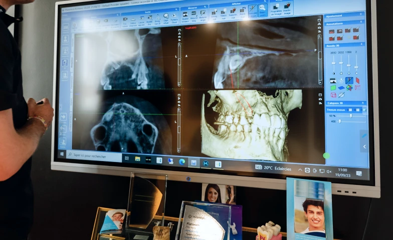 Discover optical digital impressions at Flandres Orthodontie: precision and comfort