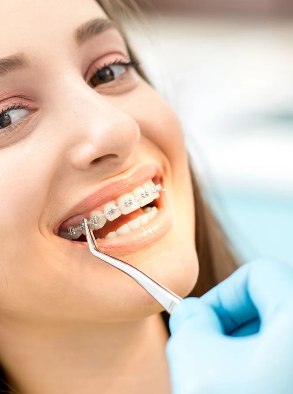 Orthodontics for teenagers in Lille and Hazebrouck: Flandres Orthodontie