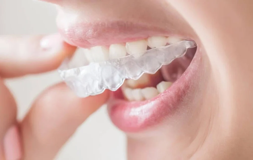 Orthodontie près de Wazemmes