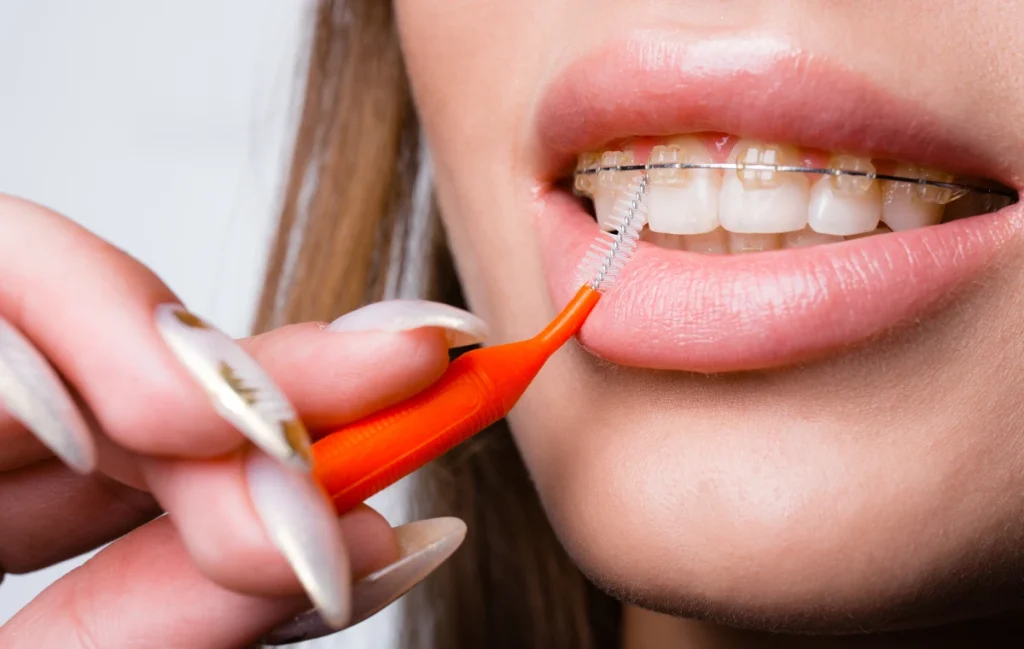 Orthodontie près de Wazemmes